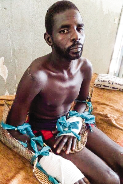 man recovering in the hospital